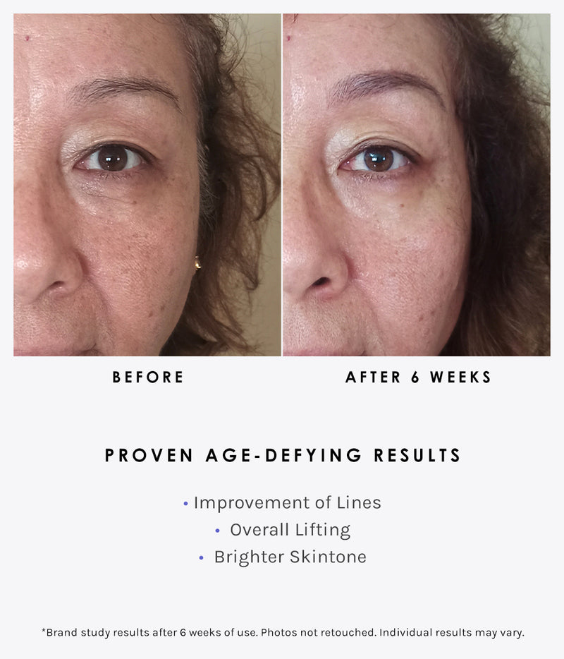 Use before and after 6 weeks of use. User shows improvement of lines, overall lifting and brighter skin tone