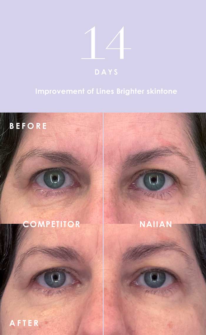 Comparison between NAIIAN and a competitor brand after 14 days of use. NAIIAN shows a bigger improvement of lines and skintone