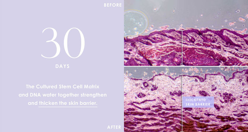 Before and After of the Skin Barrier after 30 days of using our serum. Skin Barrier looks thicker.